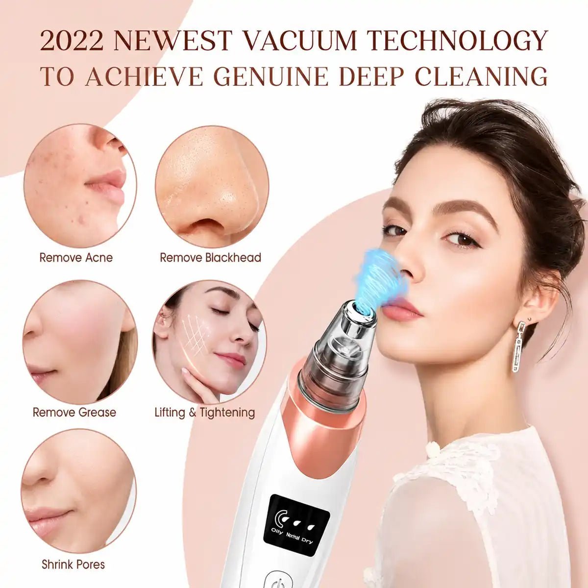 Blackhead Acne Remover For Deep Pore Cleansing 5 in 1 - ETHEREAL