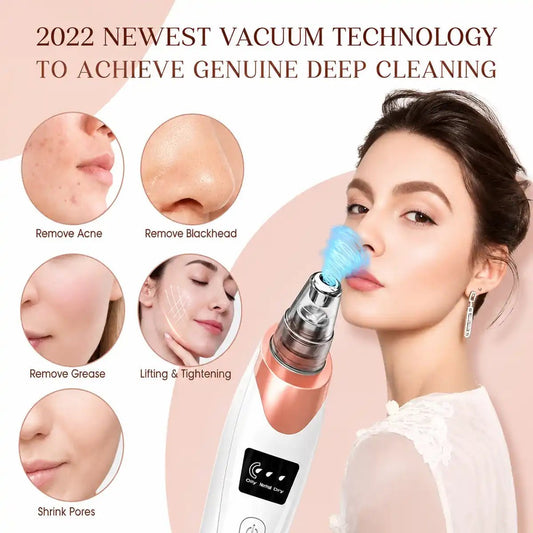 Blackhead Acne Remover For Deep Pore Cleansing 5 in 1 - ETHEREAL