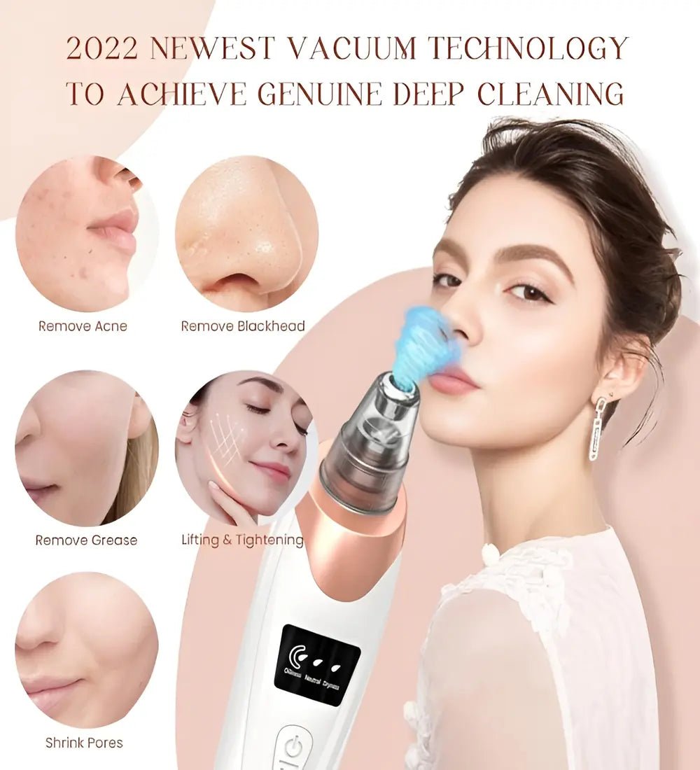 Blackhead Acne Remover For Deep Pore Cleansing 5 in 1 - VAULTMART