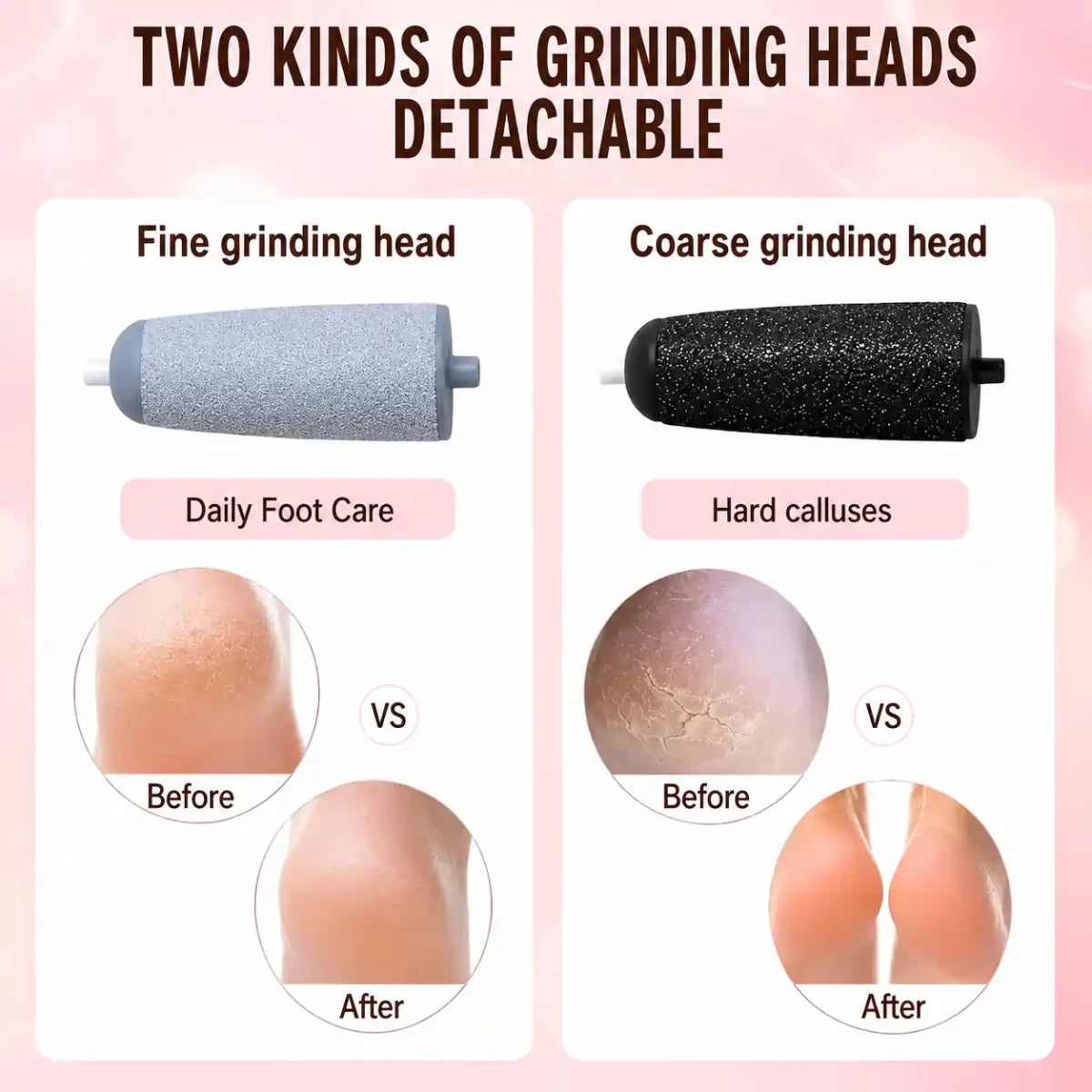 Electric Callus Remover for Dry & Cracked Feet - ETHEREAL