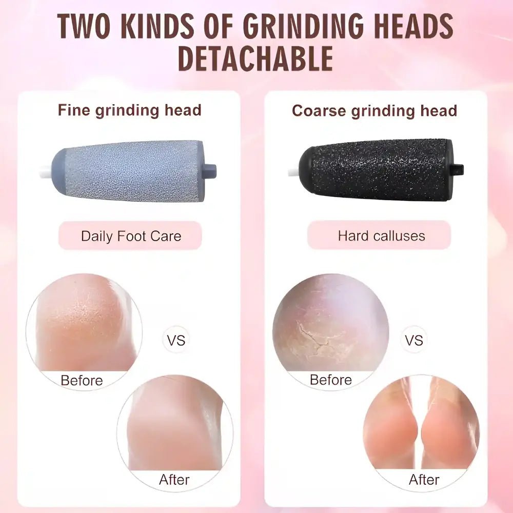 Electric Callus Remover for Dry & Cracked Feet - VAULTMART